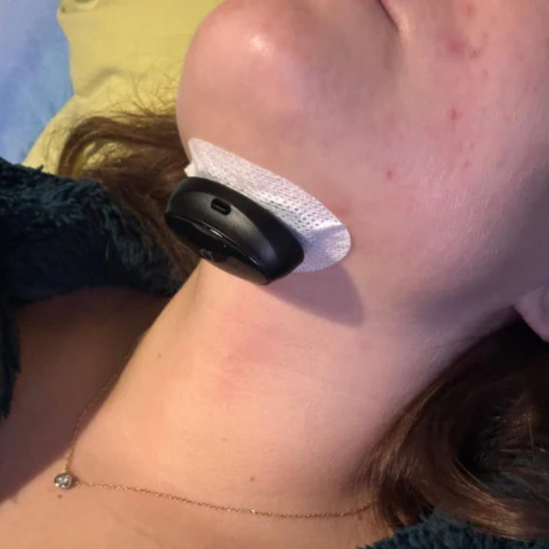Neurovia PulseAir | Smart Anti-Snoring Neurostimulation Device